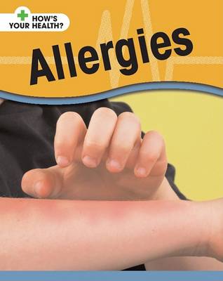 Allergies by Angela Royston