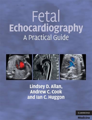 Fetal Echocardiography book