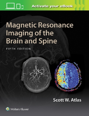 Magnetic Resonance Imaging of the Brain and Spine book