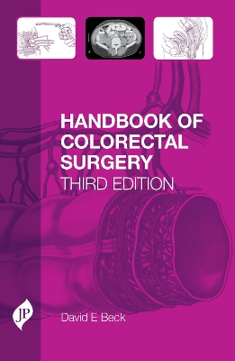 Handbook of Colorectal Surgery book