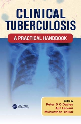 Clinical Tuberculosis book