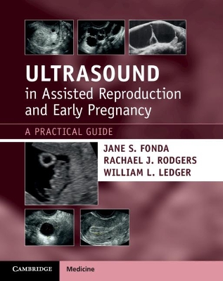 Ultrasound in Assisted Reproduction and Early Pregnancy: A Practical Guide book