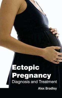 Ectopic Pregnancy book