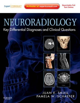 Neuroradiology: Key Differential Diagnoses and Clinical Questions by Juan E. Small