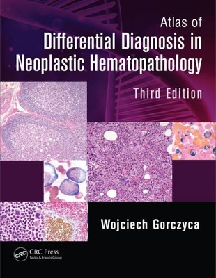 Atlas of Differential Diagnosis in Neoplastic Hematopathology by Wojciech Gorczyca