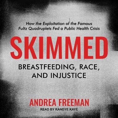 Skimmed: Breastfeeding, Race, and Injustice by Randye Kaye