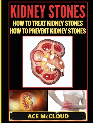 Kidney Stones by Ace McCloud