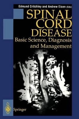 Spinal Cord Disease by Edmund Critchley