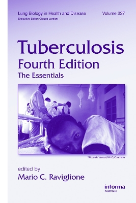 Tuberculosis by Mario C. Raviglione