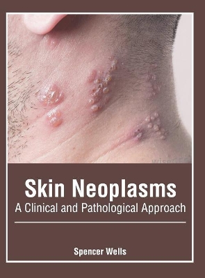 Skin Neoplasms: A Clinical and Pathological Approach book