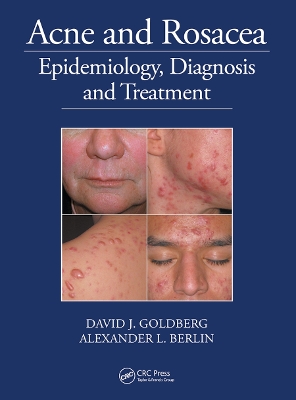 Acne and Rosacea: Epidemiology, Diagnosis and Treatment book