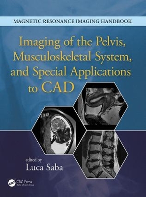 Imaging of the Pelvis, Musculoskeletal System, and Special Applications to CAD by Luca Saba
