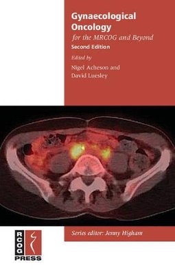 Gynaecological Oncology for the MRCOG and Beyond book