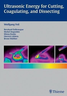 Ultrasonic Energy for Cutting, Coagulating, and Dissecting book