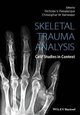 Skeletal Trauma Analysis - Case Studies in Context book