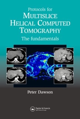 Protocols for Multislice Helical Computed Tomography by Dawson Peter