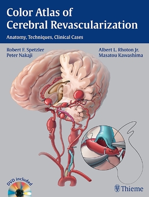 Color Atlas of Cerebral Revascularization book