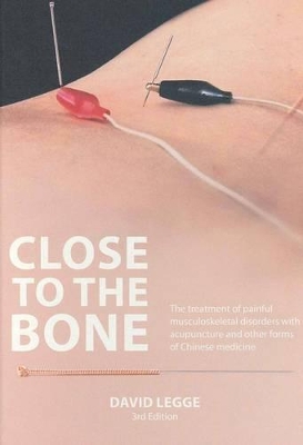 Close To The Bone: Acupuncture Treatment of Musculoskeletal Disorders by David Legge
