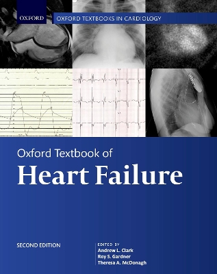 Oxford Textbook of Heart Failure book