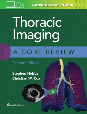 Thoracic Imaging: A Core Review book