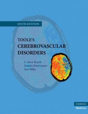 Toole's Cerebrovascular Disorders book