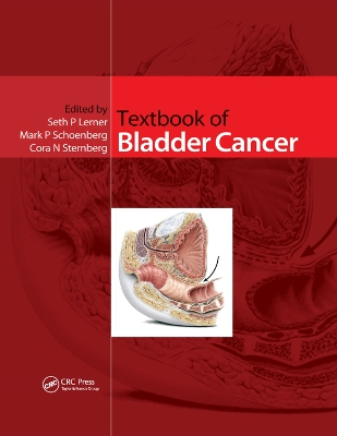 Textbook of Bladder Cancer by Seth P. Lerner