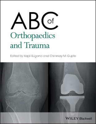 ABC of Orthopaedics and Trauma by Kapil Sugand