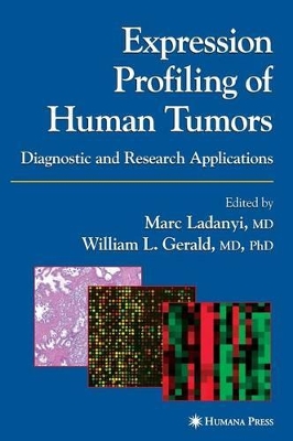 Expression Profiling of Human Tumors by Marc Ladanyi