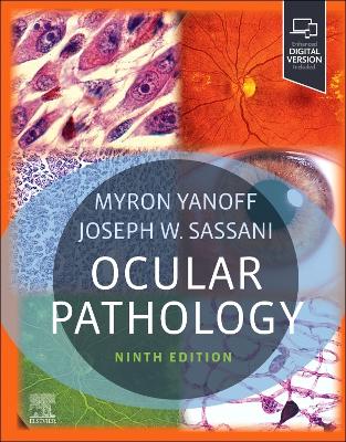 Ocular Pathology by Myron Yanoff