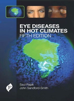 Eye Diseases in Hot Climates book