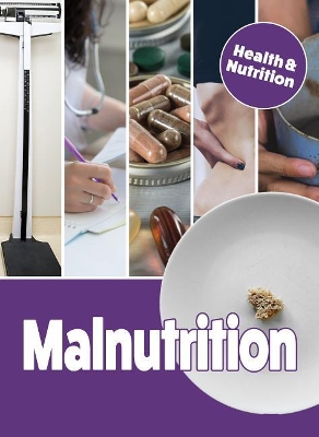 Malnutrition book