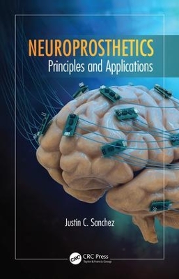 Neuroprosthetics by Justin C. Sanchez