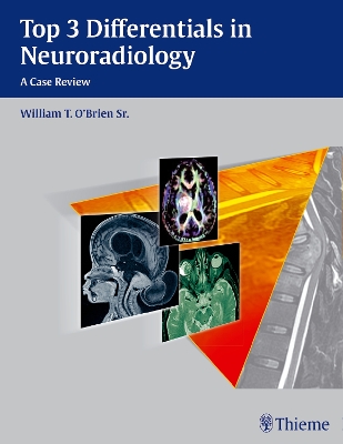 Top 3 Differentials in Neuroradiology book