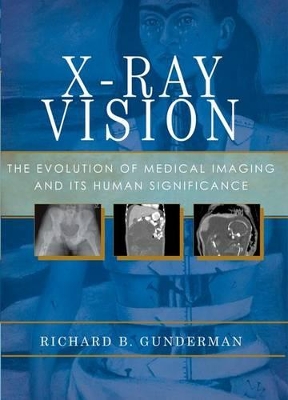 X-Ray Vision book