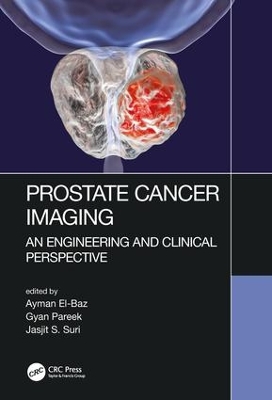 Prostate Cancer Imaging book