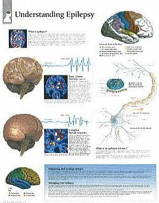 Understanding Epilepsy Paper Poster book