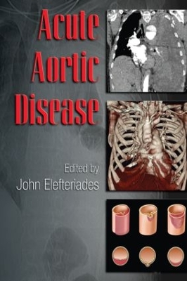 Acute Aortic Disease book