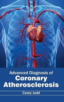 Advanced Diagnosis of Coronary Atherosclerosis book