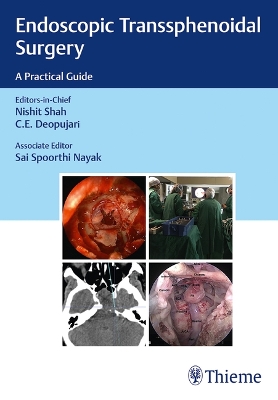 Endoscopic Transsphenoidal Surgery: A Practical Guide book