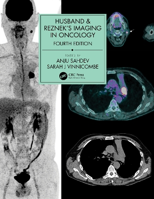 Husband & Reznek's Imaging in Oncology book