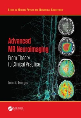 Advanced MR Neuroimaging by Ioannis Tsougos