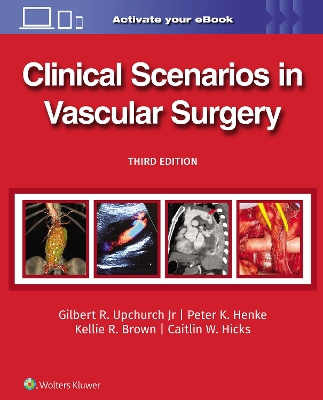 Clinical Scenarios in Vascular Surgery book