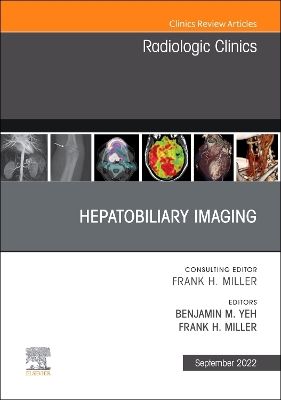 Hepatobiliary Imaging, An Issue of Radiologic Clinics of North America: Volume 60-5 book