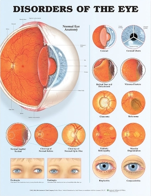 Disorders of the Eye Anatomical Chart by Anatomical Chart Company