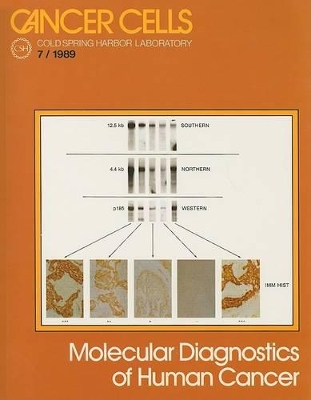Molecular Diagnostics of Human Cancer book