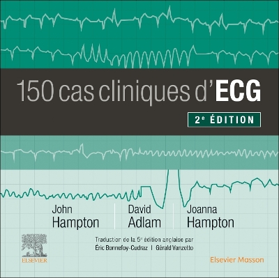 150 cas cliniques d'ECG by David Adlam