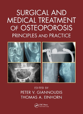 Surgical and Medical Treatment of Osteoporosis: Principles and Practice book