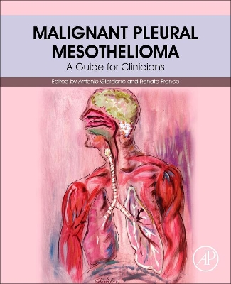 Malignant Pleural Mesothelioma book