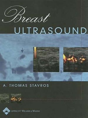 Breast Ultrasound by A. Thomas Stavros