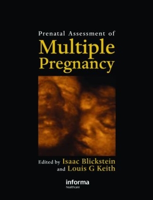 Prenatal Assessment of Multiple Pregnancy by Isaac Blickstein